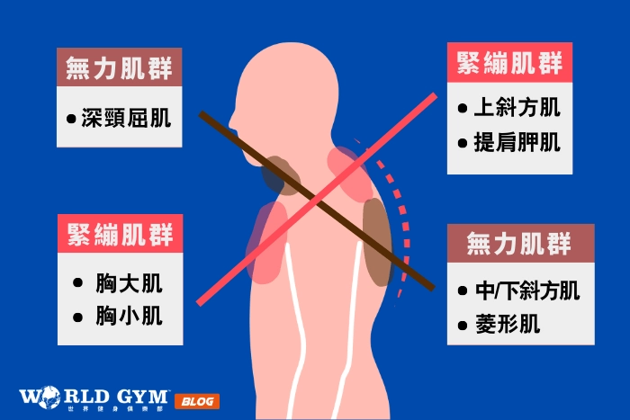 上交叉症候群是什麼