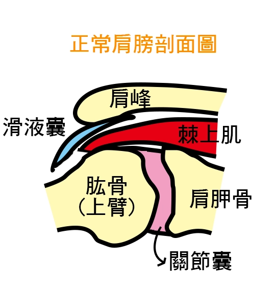 肩夾擠症候群 正常肩膀