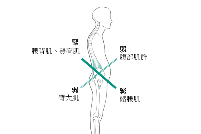 失去臀肌會造成哪些問題？