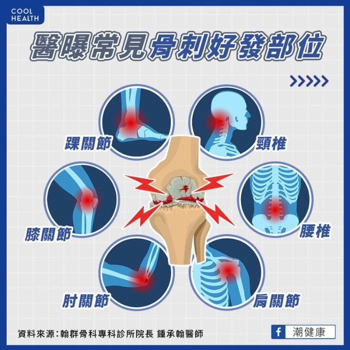 骨刺常見號發部位