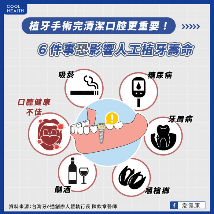 植牙完清潔更重要？如何挑選植牙醫師？