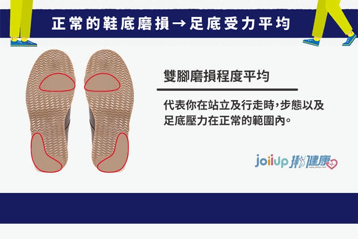 正常的鞋底磨損