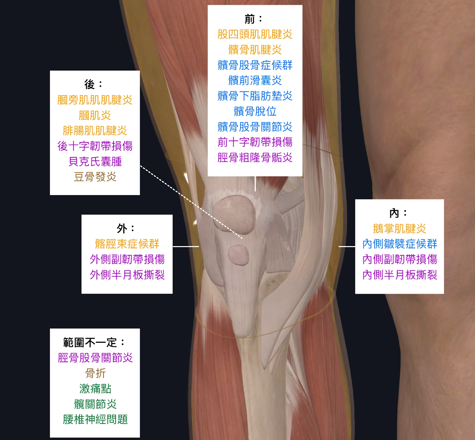 為什麼會膝蓋痛