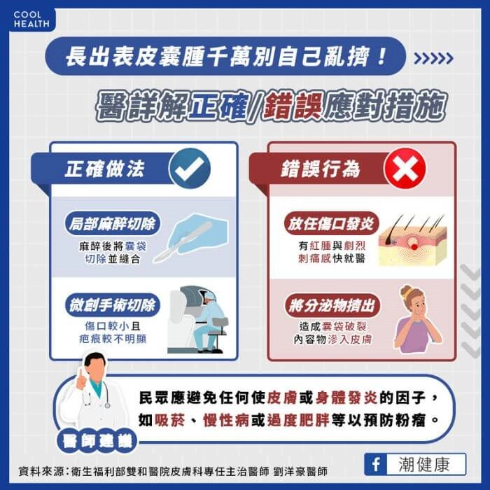 粉瘤開刀與治療方式