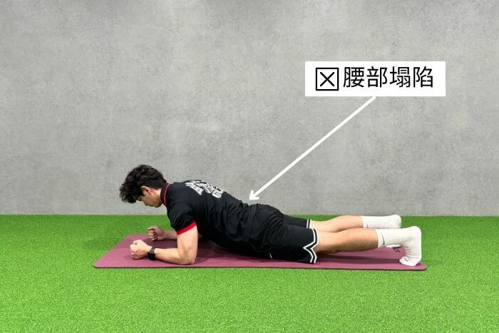 棒式腰部塌陷